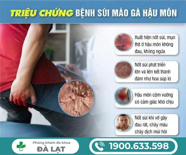 Hình ảnh minh họa